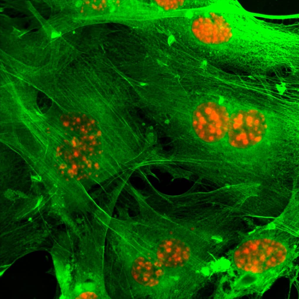 Fluorescence micrograph of cells with green filaments and red nuclei